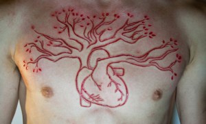 Credit: http://scarification-gallery.tumblr.com/