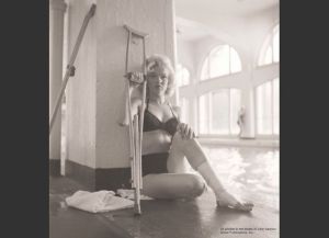 Seriously, how did she manage to make crutches so alluring?