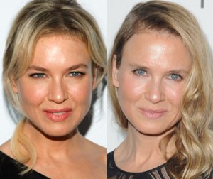 why-renee-zellwegers-face-is-an-aging-issue