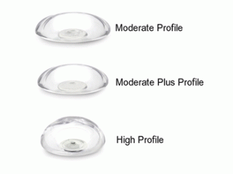 Implant Profile