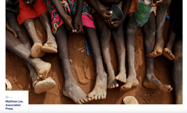 overconsumption hurts, as does&nbsp;hunger.